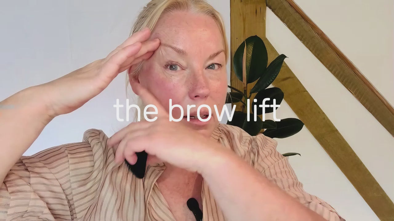 3. Brow lift
